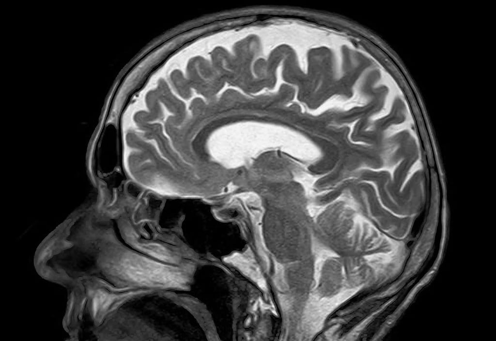 Neuroplasticity Practices Rewiring Perceptions
